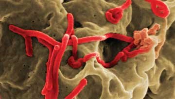 Statement to stakeholders: Outbreak of Ebola Virus Disease (EVD)